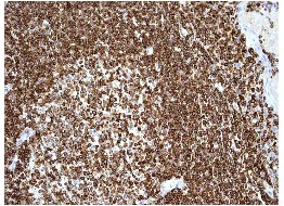 Immunohistochemistry (Formalin/PFA-fixed paraffin-embedded sections) - Anti-LSP1 antibody [EPR3160] (AB134099)