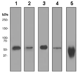 Western blot - Anti-LSP1 antibody [EPR3160] - BSA and Azide free (AB248682)