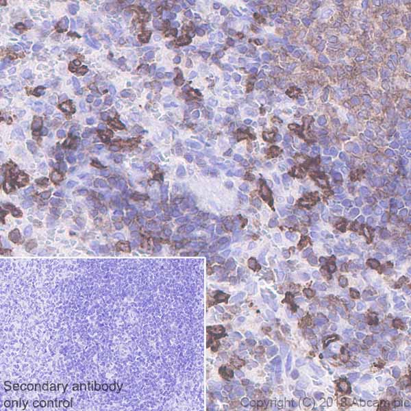 Immunohistochemistry (Formalin/PFA-fixed paraffin-embedded sections) - Anti-LSP1 antibody [EPR5997] (AB133506), expandable thumbnail