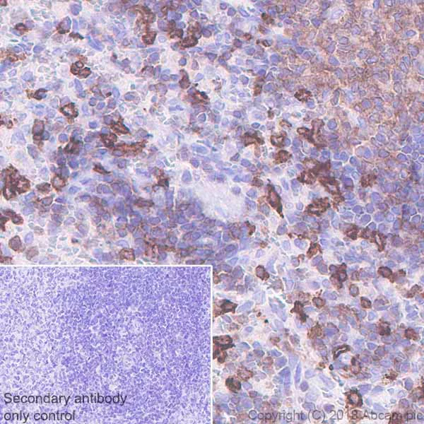 Immunohistochemistry (Formalin/PFA-fixed paraffin-embedded sections) - Anti-LSP1 antibody [EPR5997] (AB133506)