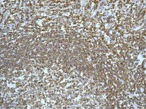 Immunohistochemistry (Formalin/PFA-fixed paraffin-embedded sections) - Anti-LSP1 antibody [EPR5997] (AB133506)