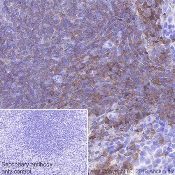 Immunohistochemistry (Formalin/PFA-fixed paraffin-embedded sections) - Anti-LSP1 antibody [EPR5997] (AB133506), expandable thumbnail
