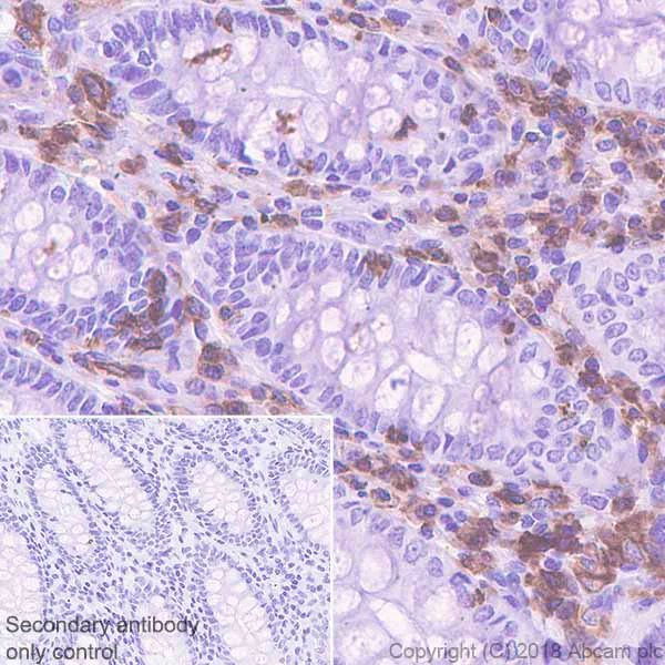 Immunohistochemistry (Formalin/PFA-fixed paraffin-embedded sections) - Anti-LSP1 antibody [EPR5997] (AB133506)