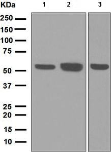 Western blot - Anti-LSP1 antibody [EPR5997] (ab133506), expandable thumbnail