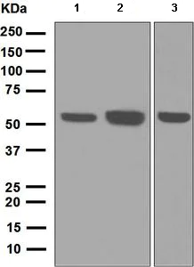 Western blot - Anti-LSP1 antibody [EPR5997] (AB133506)