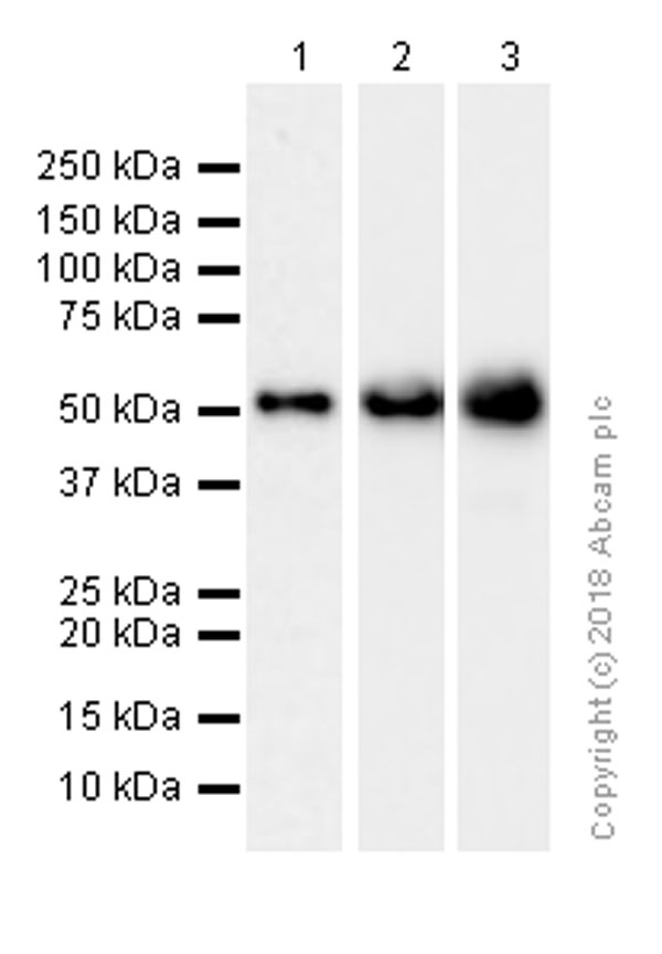 Western blot - Anti-LSP1 antibody [EPR5997] (AB133506), expandable thumbnail