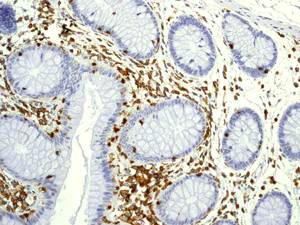 Immunohistochemistry (Formalin/PFA-fixed paraffin-embedded sections) - Anti-LSP1 antibody [EPR5997] - BSA and Azide free (AB240063)