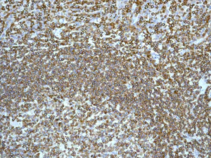 Immunohistochemistry (Formalin/PFA-fixed paraffin-embedded sections) - Anti-LSP1 antibody [EPR5997] - BSA and Azide free (AB240063)