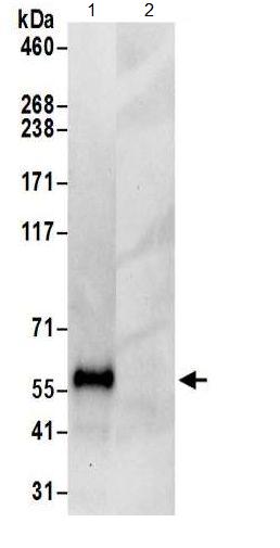 Immunoprecipitation - Anti-LSR antibody (AB191180)