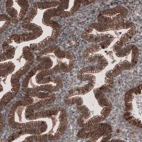 Immunohistochemistry (Formalin/PFA-fixed paraffin-embedded sections) - Anti-LSR antibody (AB224237)