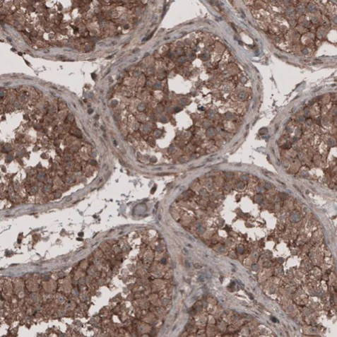 Immunohistochemistry (Formalin/PFA-fixed paraffin-embedded sections) - Anti-LSR antibody (AB224237)