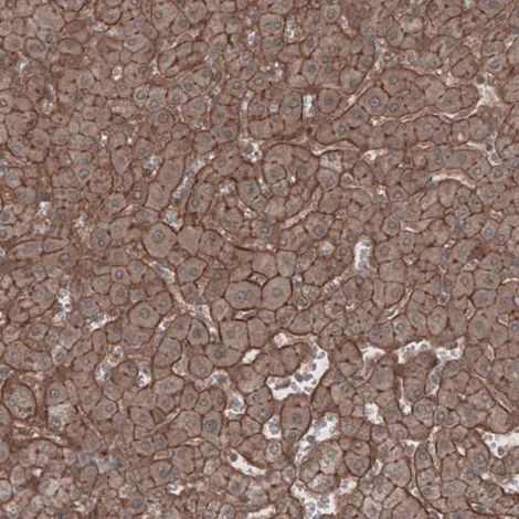 Immunohistochemistry (Formalin/PFA-fixed paraffin-embedded sections) - Anti-LSR antibody (AB224237)