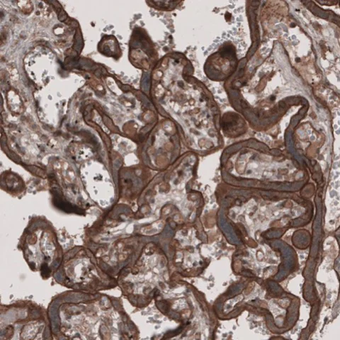 Immunohistochemistry (Formalin/PFA-fixed paraffin-embedded sections) - Anti-LSR antibody (AB224237)