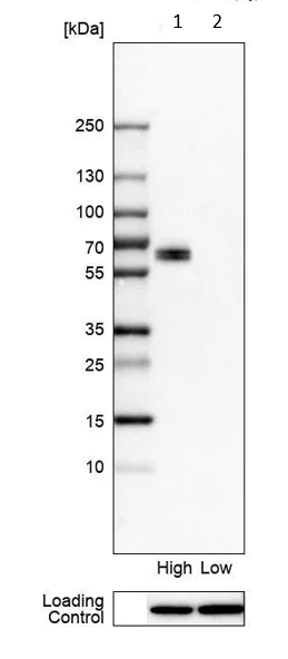 Western blot - Anti-LSR antibody (AB224237)