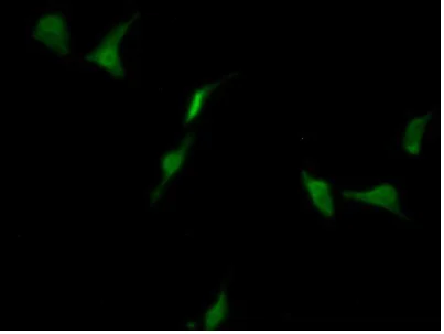 Immunocytochemistry/ Immunofluorescence - Anti-LSR antibody (AB232780)