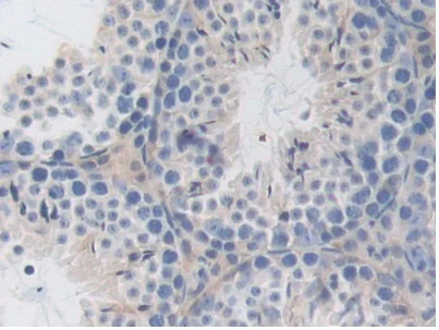 Immunohistochemistry (Formalin/PFA-fixed paraffin-embedded sections) - Anti-LSR antibody (AB232780)