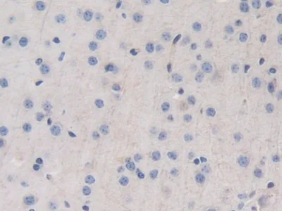 Immunohistochemistry (Formalin/PFA-fixed paraffin-embedded sections) - Anti-LSR antibody (AB232780)