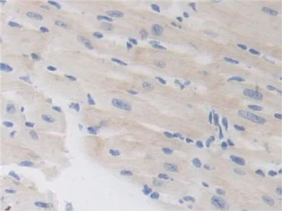Immunohistochemistry (Formalin/PFA-fixed paraffin-embedded sections) - Anti-LSR antibody (AB232780)