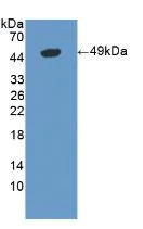 Western blot - Anti-LSR antibody (AB232780)
