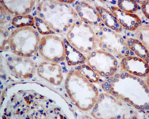 Immunohistochemistry (Formalin/PFA-fixed paraffin-embedded sections) - Anti-LSS antibody [EPR6703] (AB140124)