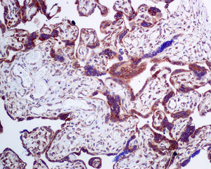 Immunohistochemistry (Formalin/PFA-fixed paraffin-embedded sections) - Anti-LSS antibody [EPR6703] (AB140124), expandable thumbnail