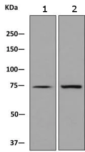 Western blot - Anti-LSS antibody [EPR6703] (AB140124)