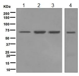 Western blot - Anti-LSS antibody [EPR6704(B)] (AB124785)