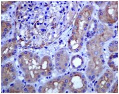 Immunohistochemistry (Formalin/PFA-fixed paraffin-embedded sections) - Anti-LSS antibody [EPR6704(B)] - BSA and Azide free (AB248003)