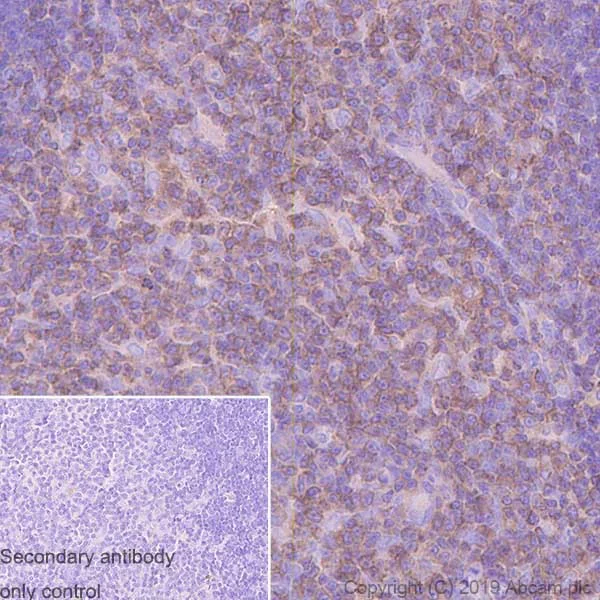 Immunohistochemistry (Formalin/PFA-fixed paraffin-embedded sections) - Anti-LST1 antibody [7E2] (AB252839)