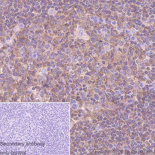 Immunohistochemistry (Formalin/PFA-fixed paraffin-embedded sections) - Anti-LST1 antibody [7E2] (AB252839)