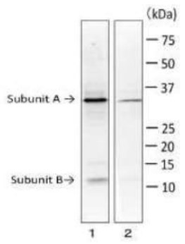 Western blot - Anti-LT subunit (A + B) antibody (AB188541), expandable thumbnail