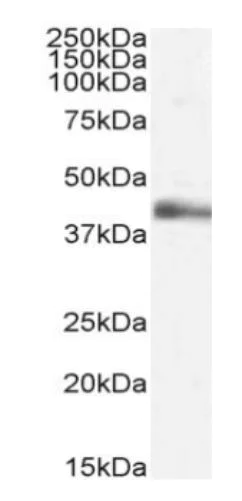 Western blot - Anti-LTA antibody [3F12.2D3] (AB288417)