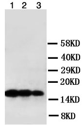 Western blot - Anti-LTA antibody (AB106353)