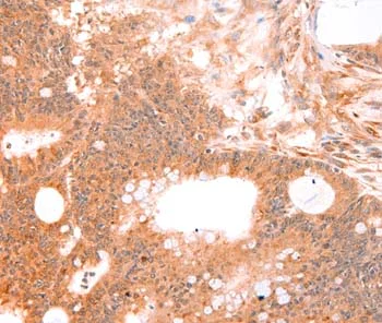 Immunohistochemistry (Formalin/PFA-fixed paraffin-embedded sections) - Anti-LTA antibody (AB197677)