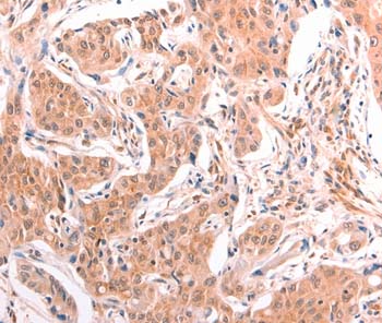 Immunohistochemistry (Formalin/PFA-fixed paraffin-embedded sections) - Anti-LTA antibody (AB197677)