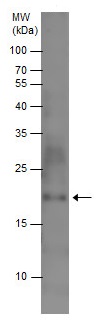 Western blot - Anti-LTA antibody (AB227929), expandable thumbnail