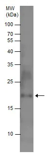 Western blot - Anti-LTA antibody (AB227929)