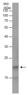 Western blot - Anti-LTA antibody (AB227929), expandable thumbnail