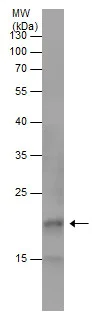 Western blot - Anti-LTA antibody (AB227929)