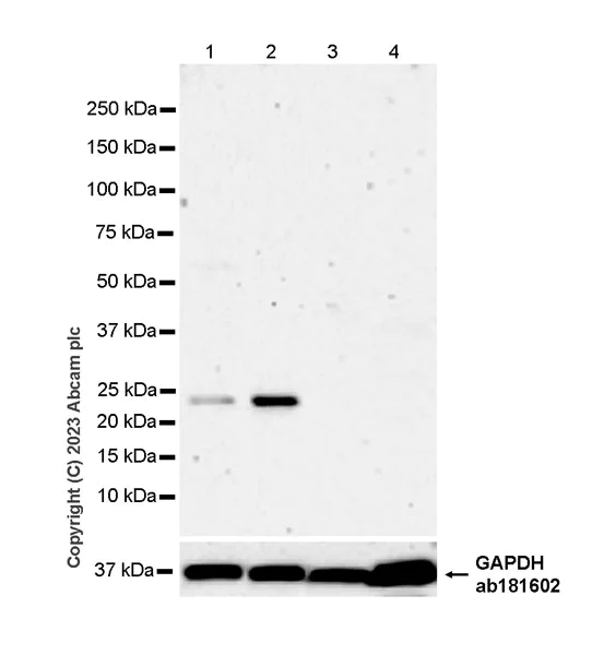 Western blot - Anti-LTA antibody [EPR25917-74] (AB314858)