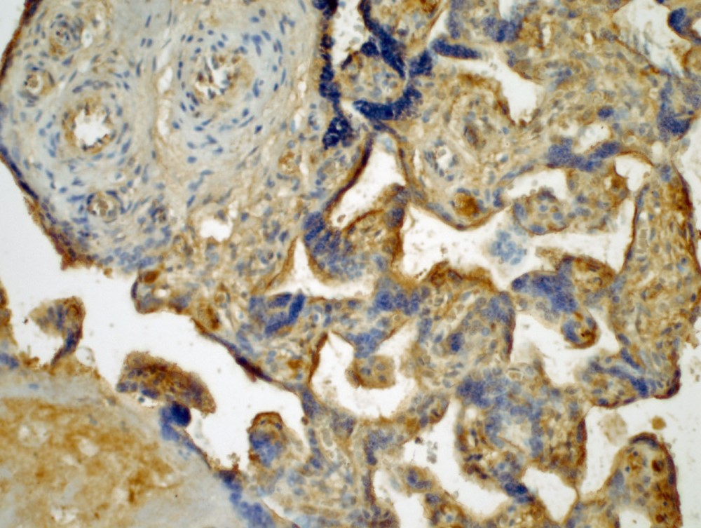 Immunohistochemistry (Formalin/PFA-fixed paraffin-embedded sections) - Anti-LTA antibody [MM0460-12B4] (AB89566)