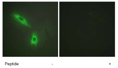 Immunocytochemistry/ Immunofluorescence - Anti-LTB antibody (AB64835)
