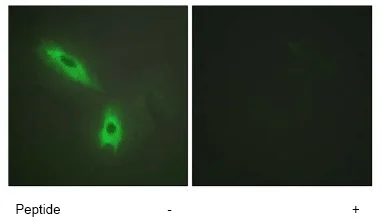 Immunocytochemistry/ Immunofluorescence - Anti-LTB antibody (AB64835)