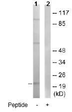 Western blot - Anti-LTB antibody (AB64835)