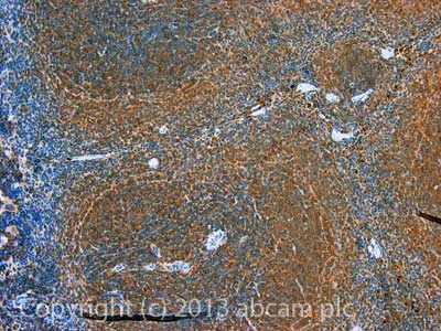 Immunohistochemistry (Formalin/PFA-fixed paraffin-embedded sections) - Anti-LTBP1 antibody (AB78294)