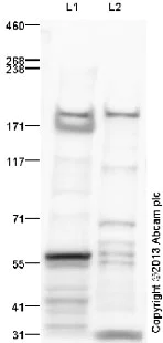 Western blot - Anti-LTBP1 antibody (AB78294)