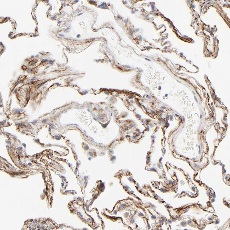 Immunohistochemistry (Formalin/PFA-fixed paraffin-embedded sections) - Anti-LTBP2 antibody (AB121193)