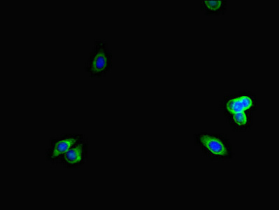 Immunocytochemistry/ Immunofluorescence - Anti-LTBP4 antibody (AB222844), expandable thumbnail