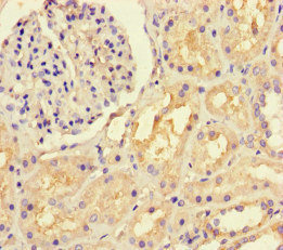 Immunohistochemistry (Formalin/PFA-fixed paraffin-embedded sections) - Anti-LTBP4 antibody (AB222844), expandable thumbnail