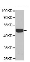 Western blot - Anti-LTBR antibody (AB186847)